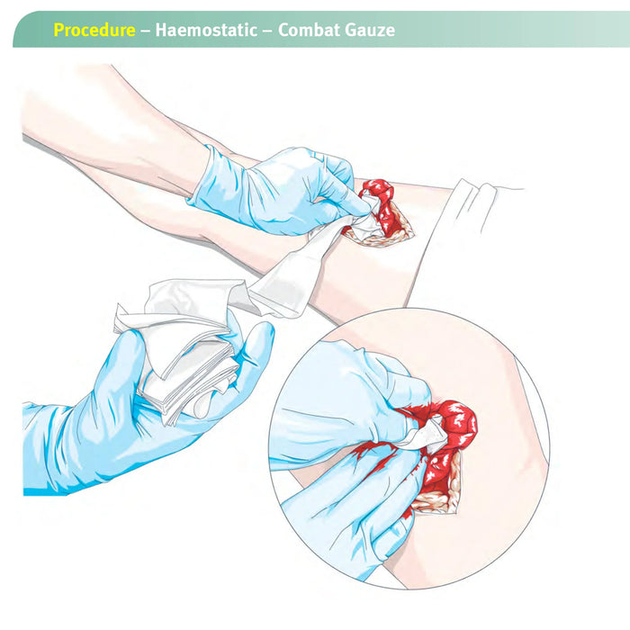Gasa hemostática de caolín para traumatismos de emergencia, plegado en Z, soluble para botiquín de primeros auxilios táctico Ifak, apósito médico para heridas